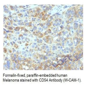 Anti-ICAM1 Mouse Monoclonal Antibody