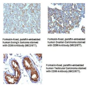 Anti-CD99 Mouse Monoclonal Antibody