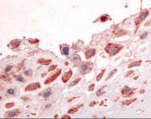 Anti-DDR1 Rabbit Polyclonal Antibody