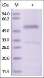 Human Recombinant Serpin H1