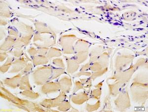 Anti-CTHRC1 Rabbit Polyclonal Antibody