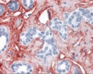 Anti-COL6A1 Rabbit Polyclonal Antibody