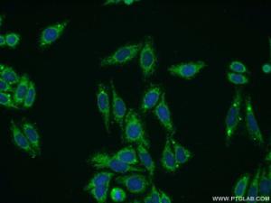 Anti-Collagen Type VIII Rabbit Polyclonal Antibody