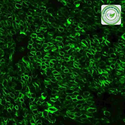 Alkaline Phosphatase Conjugated anti-Human IgG SABC Kit HG-SA1054