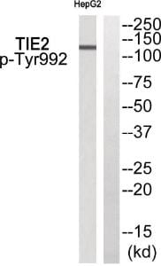 Anti-TEK Rabbit Polyclonal Antibody