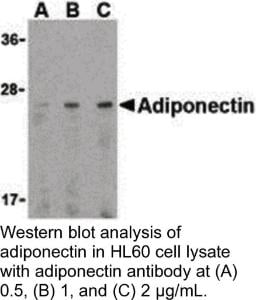 Anti-ADIPOQ Rabbit Polyclonal Antibody