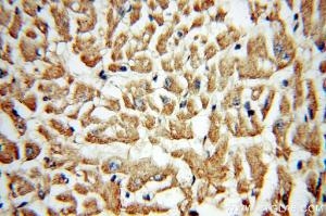 Anti-Collagen Type VI Rabbit Polyclonal Antibody