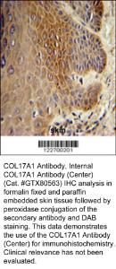Anti-COL17A1 Rabbit Polyclonal Antibody