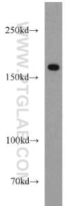 Anti-Collagen Type XVI Rabbit Polyclonal Antibody