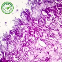 Human Epidermal Melanocyte Cells