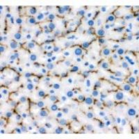 FITC + POD Conjugated anti-Rat IgG SABC Kit N-SA1085