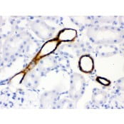 HRP Conjugated anti-Rabbit IgG Super Vision Assay Kit N-SV0002-2