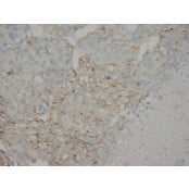 Anti-AFP Antibody CA1001